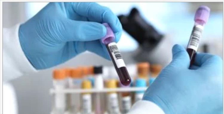 كيف تكتشف نقص الحديد.. الأعراض وطرق العلاج