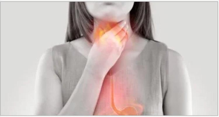 ليست حموضة عادية .. دراسة تكشف علامات مبكرة لسرطان المرىء