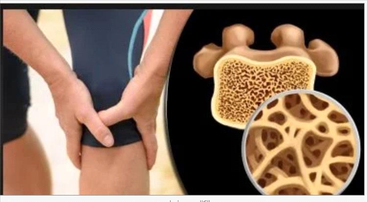 الكالسيوم مقابل فيتامين د.. أيهما أفضل لصحة العظام؟