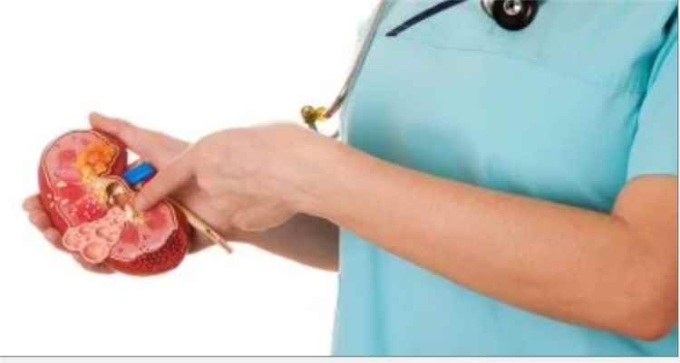 FDA توافق على علاج جديد لاعتلال الكلى المناعى