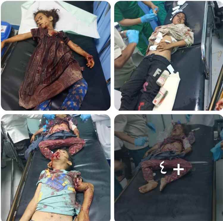 مأساة في الضالع.. 5 أطفال ضحايا انفجار مخلفات الحرب بقرية الريبي