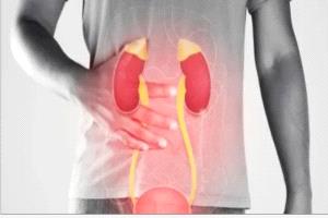 5 عادات يومية تضر بصحة الكلى في صمت